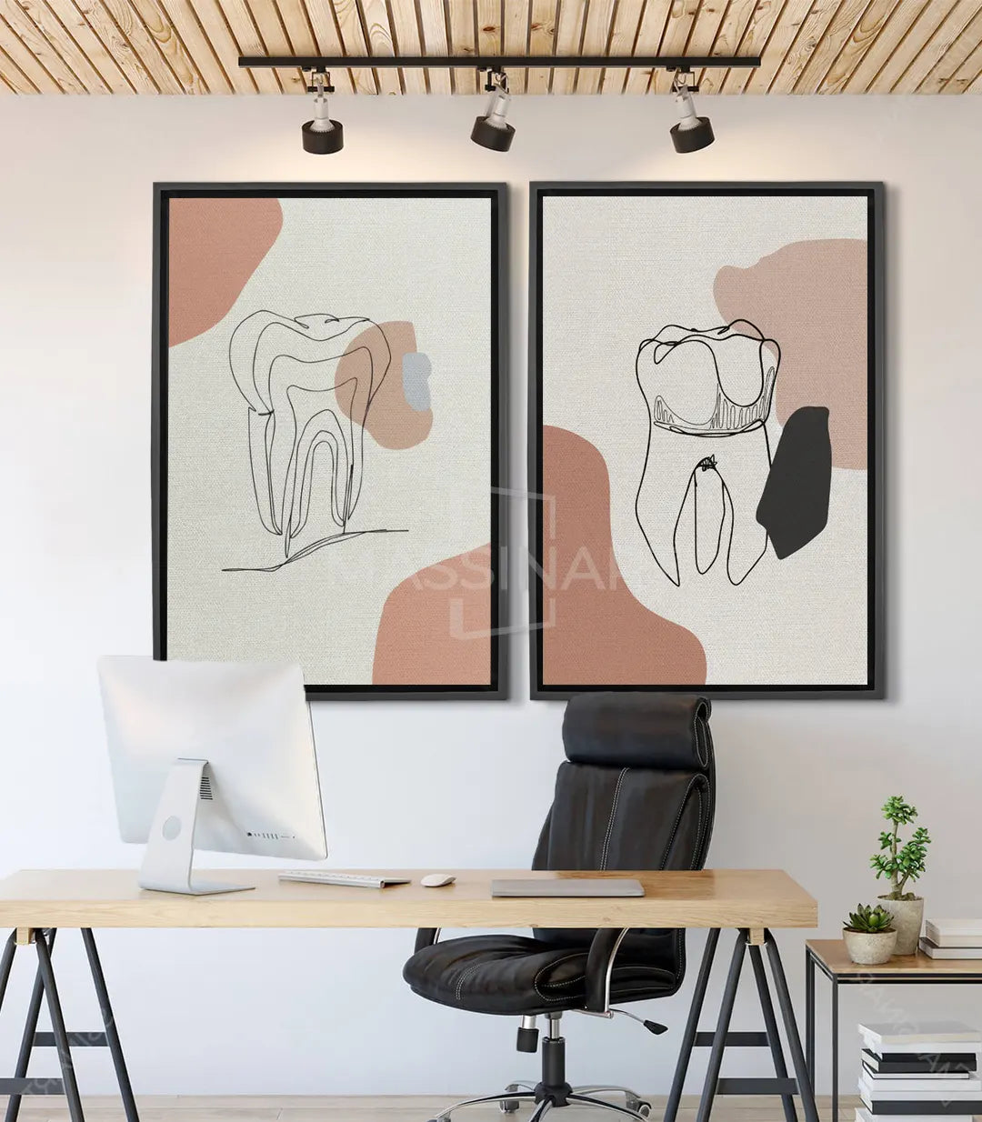 Cuadro Tooth Outline díptico — dos dientes minimalistas en línea continua, beige y blanco, Massinart