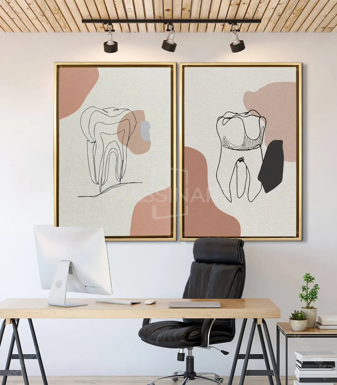 Decoración de consulta médica con cuadro diente minimalista arte dental — Massinart
