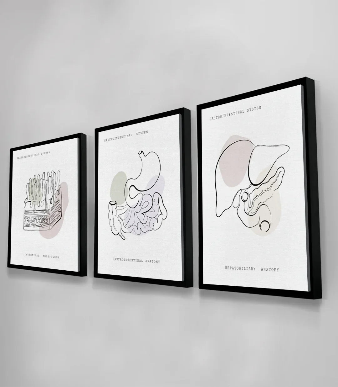 Cuadro Gastro Art tríptico, arte médico minimalista línea fina Massinart