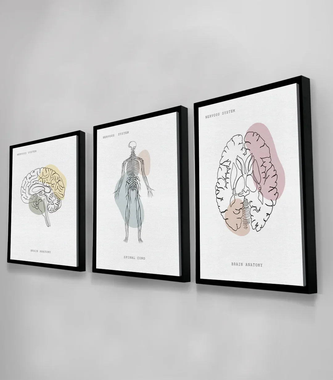 Cuadro Neural Network ambiente oficina Massinart — tríptico diseño depurado